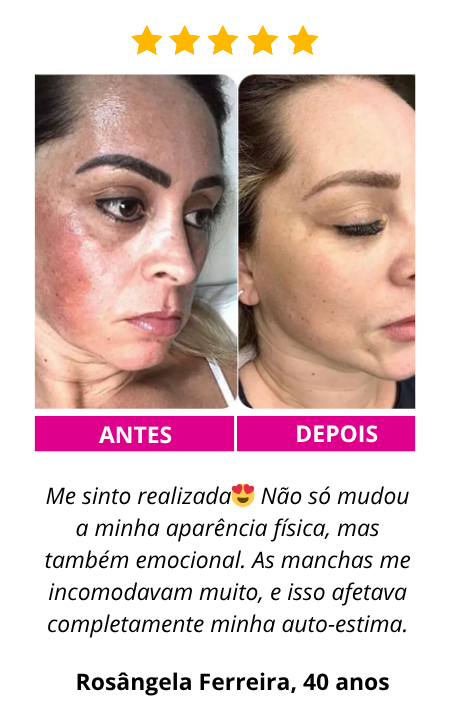 2.2